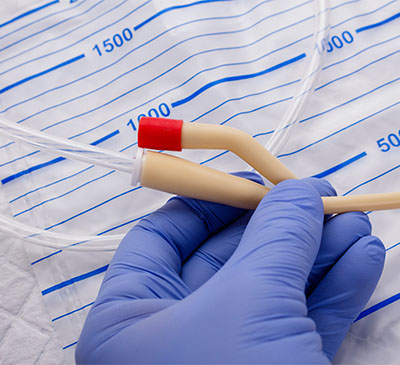 Global Ureteral Catheters Market 2019-2023